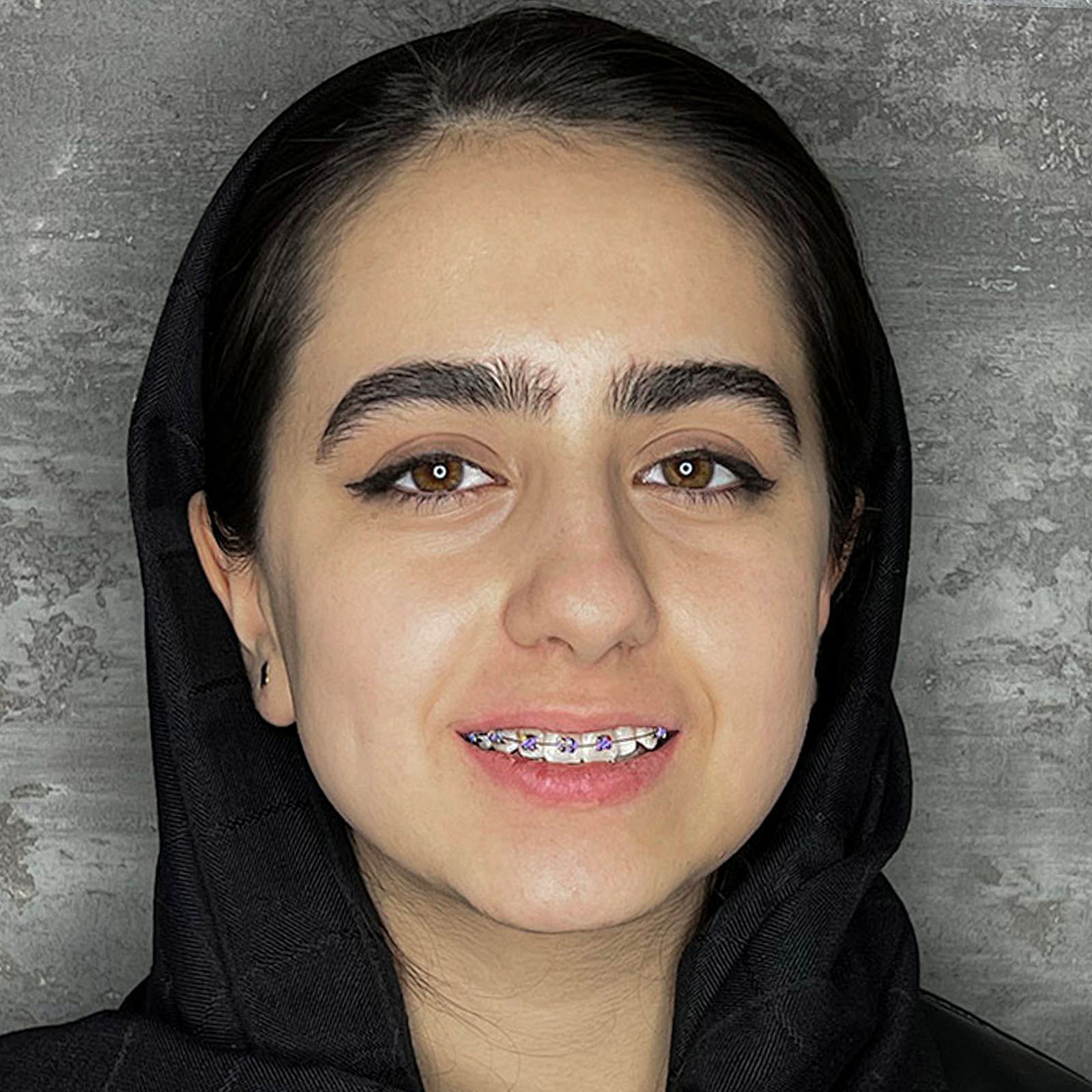 ارتودنسی دندان درمانگاه زندیه شیراز