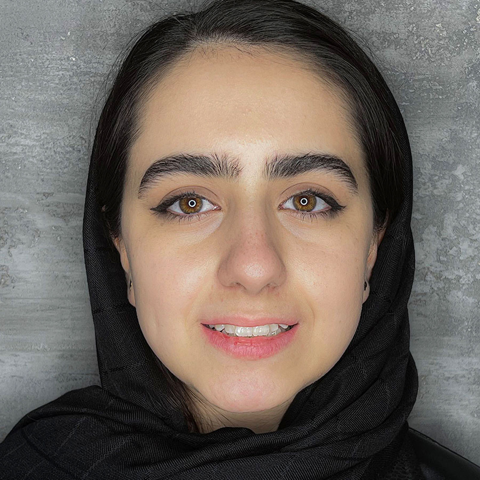 ارتودنسی دندان درمانگاه زندیه شیراز