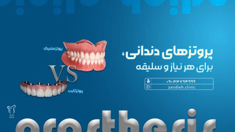 پروتز دندان در شیراز