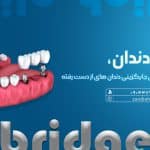 بریج دندان در شیراز