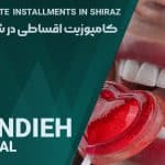 کامپوزیت اقساطی در شیراز