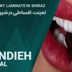 لمینت اقساطی در شیراز