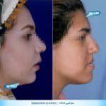 نمونه کار جراحی فک در شیراز