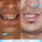 نمونه کار جراحی فک در شیراز