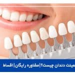 لمینت دندان چیست؟