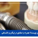 پروتز دندان چیست؟