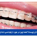 ارتودنسی دندان چیست؟ همه چیز در مورد ارتودنسی دندان