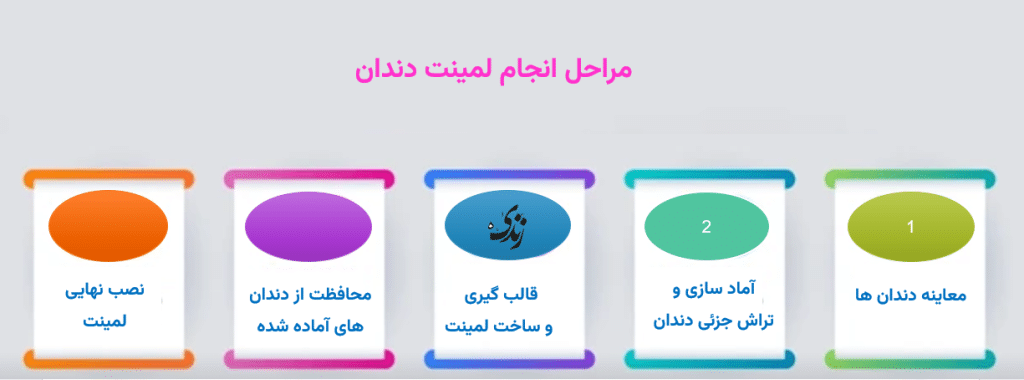 مراحل نصب لمینت دندان