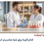 بریج یا ایمپلنت: کدام گزینه برای شما مناسبتر است؟