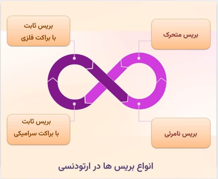 بررسی انواع بریس ها