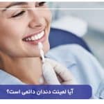 آیا لمینت دندان دائمی است؟