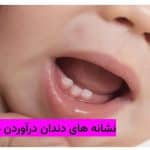 نشانه های دندان درآوردن نوزاد