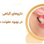 داروهای گیاهی در بهبود عفونت های لثه و دندان