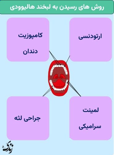 روش های رسیدن به لبخند هالیوودی