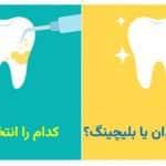 جرمگیری دندان یا بلیچینگ؟ کدام را انتخاب کنیم؟