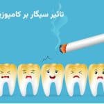 تاثیر سیگار بر کامپوزیت دندان