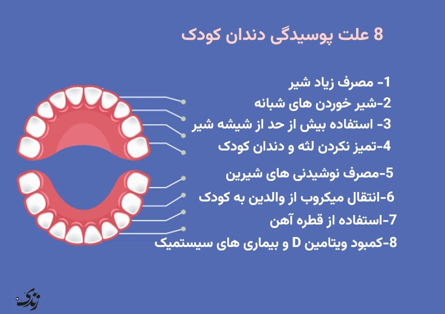 بررسی و شناخت علت خراب شدن دندان کودک شیرخوار