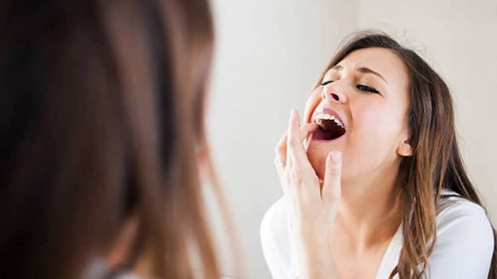 زرد شدن دندان نشانه کمبود چیست؟