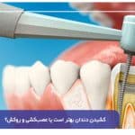 کشیدن دندان بهتر است یا عصب‌کشی و روکش؟