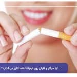 آیا سیگار و قلیان روی ایمپلنت شما تاثیر می گذارد؟