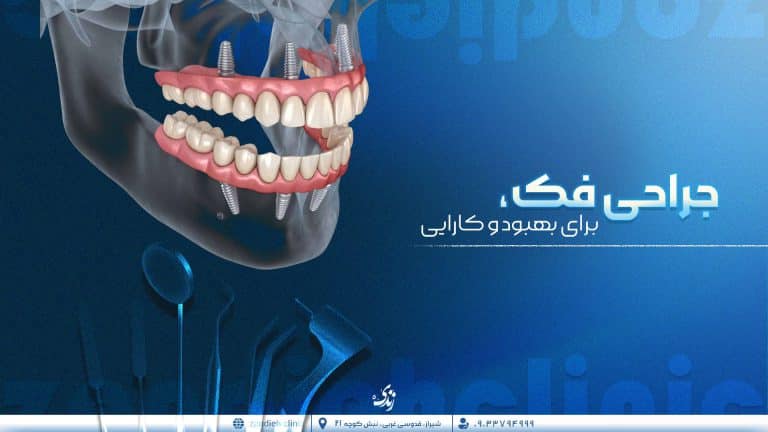 جراحی فک و صورت در شیراز