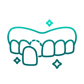 لمینیت دندان