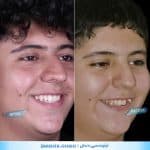 ارتودنسی 50