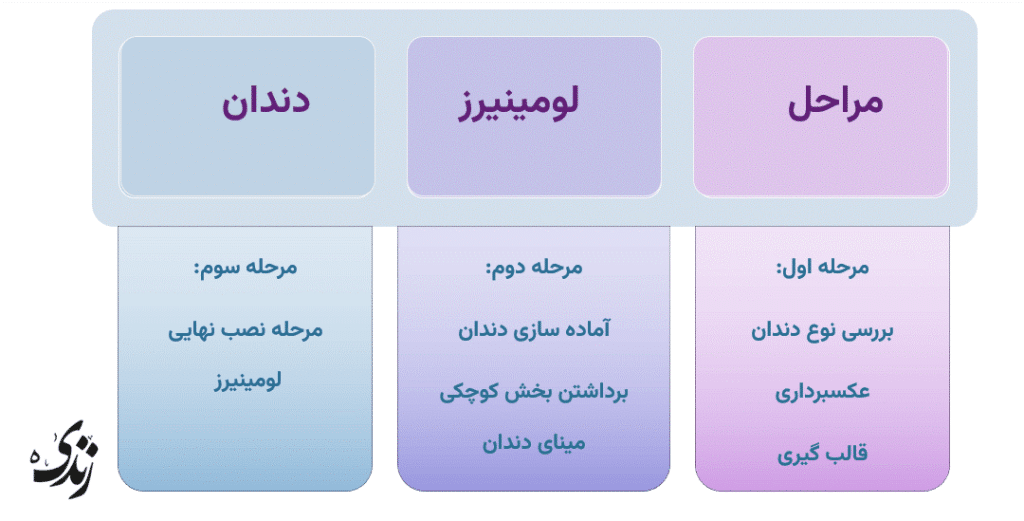 بررسی مراحل لومینیرز دندان