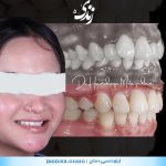 ارتودنسی 67