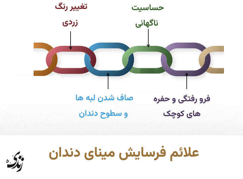 بررسی علائم فرسایش مینای دندان