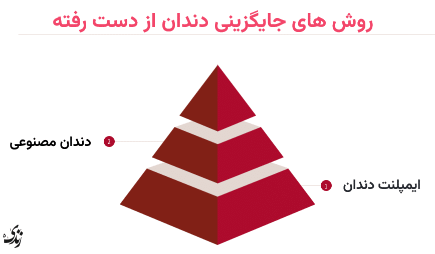 دو روش برای جایگزینی دندان های از دست رفته