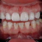 لمینت 13