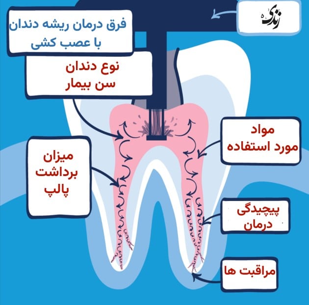 بررسی فرق درمان ریشه دندان با عصب کشی