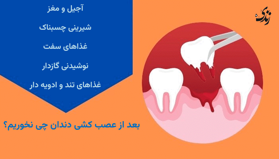 بعد از عصب کشی این غذاها را نخوریم؟
