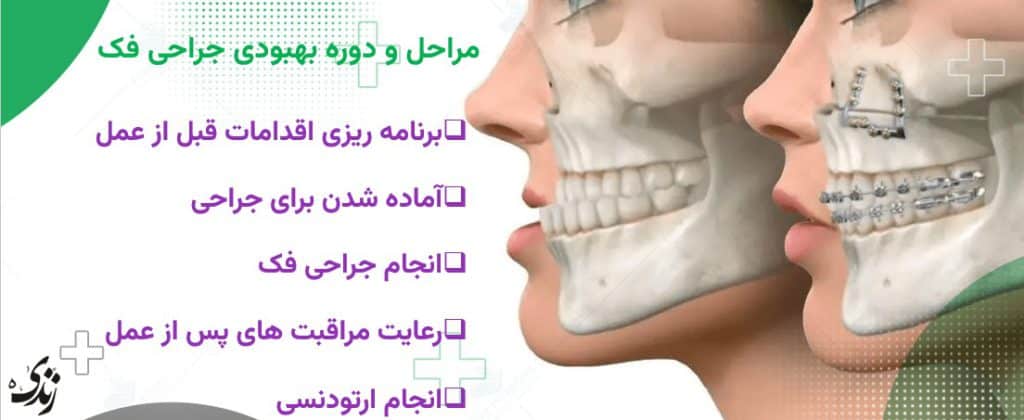 مراحل انجام جراحی فک