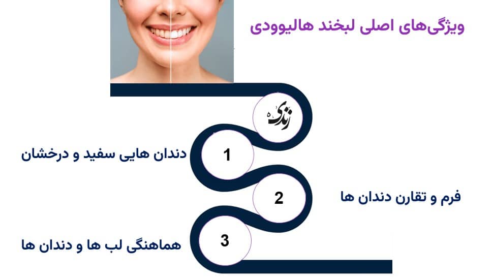 بررسی ویژگی‌های اصلی لبخند هالیوودی