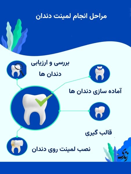 مراحل انجام لمینت دندان