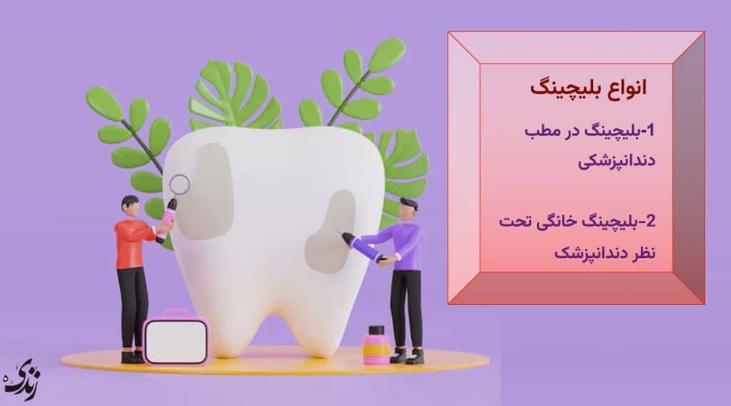 انواع بلیچینگ دندان