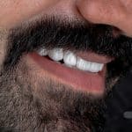 لمینت 10