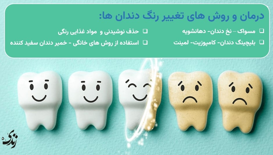 معرفی درمان و روش های تغییر رنگ دندان ها
