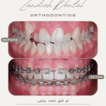 ارتودنسی 70