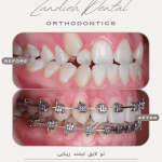 ارتودنسی 71