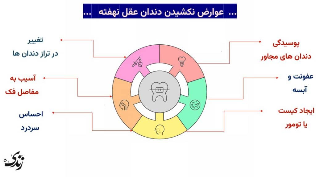 بررسی عوارض نکشیدن دندان عقل نهفته