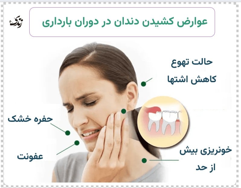 بررسی عوارض کشیدن دندان در دوران بارداری