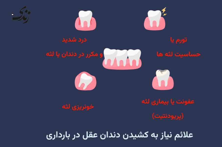برخی از علائمی که نشان می دهند در دوران بارداری نیاز به کشیدن دندان دارید.