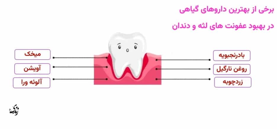 بهترین داروهای گیاهی در بهبود عفونت های لثه و دندان
