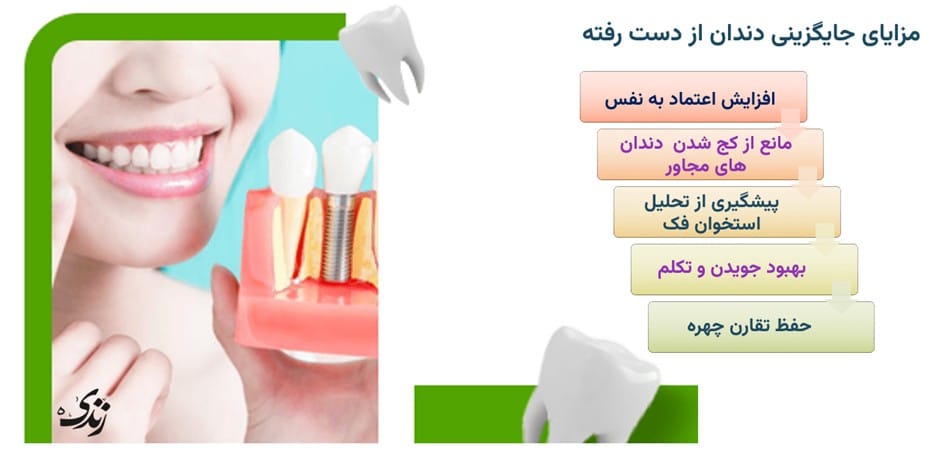 بررسی مزایای جایگزینی دندان از دست رفته