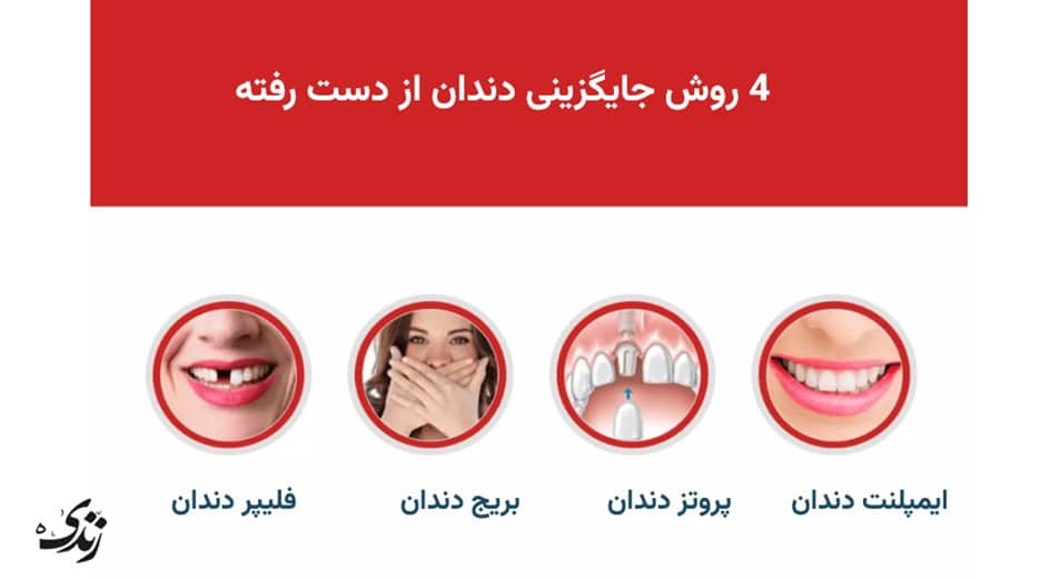4 روش جایگزینی دندان از دست رفته