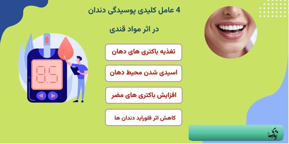 عوامل پوسیدگی دندان بر اثر مواد قندی