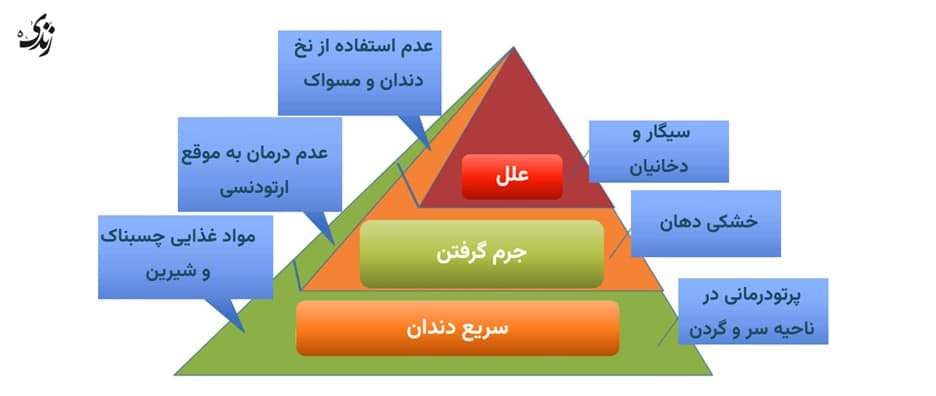 بررسی علل جرم گیری سریع دندان ها